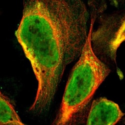 MRPL52 Antibody, Novus Biologicals:Antibodies:Primary Antibodies